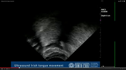  Studying the endangered Irish tongue&mdash;literally 
